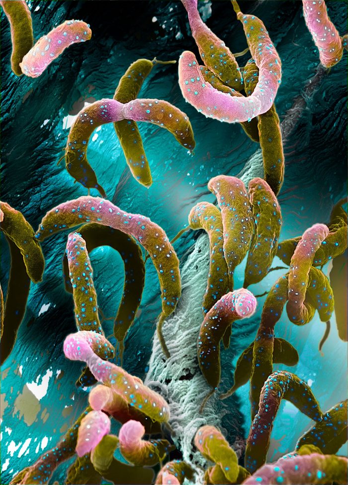 Caulo Bacter (fotografía real bacteria)