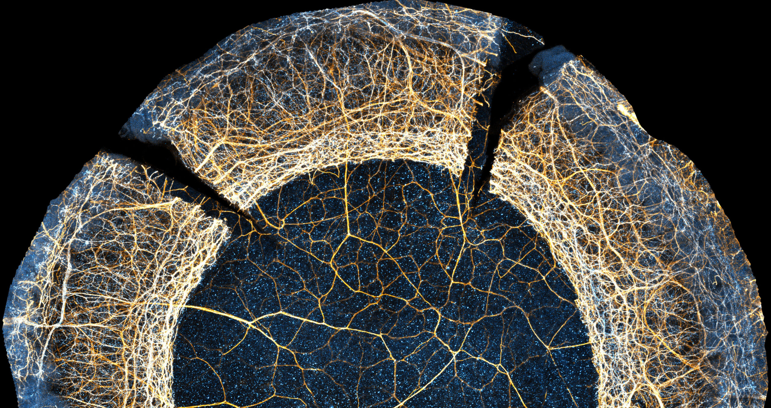 Axones neuronales al ojo